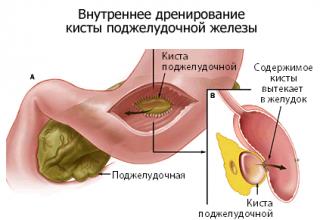 podg4