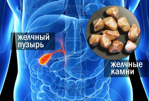 gelchniy
