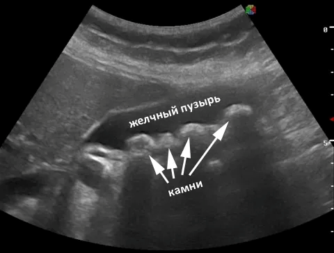 kamni gelchniy