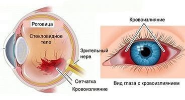 Артериальное-давление-и-орган-зрения-08