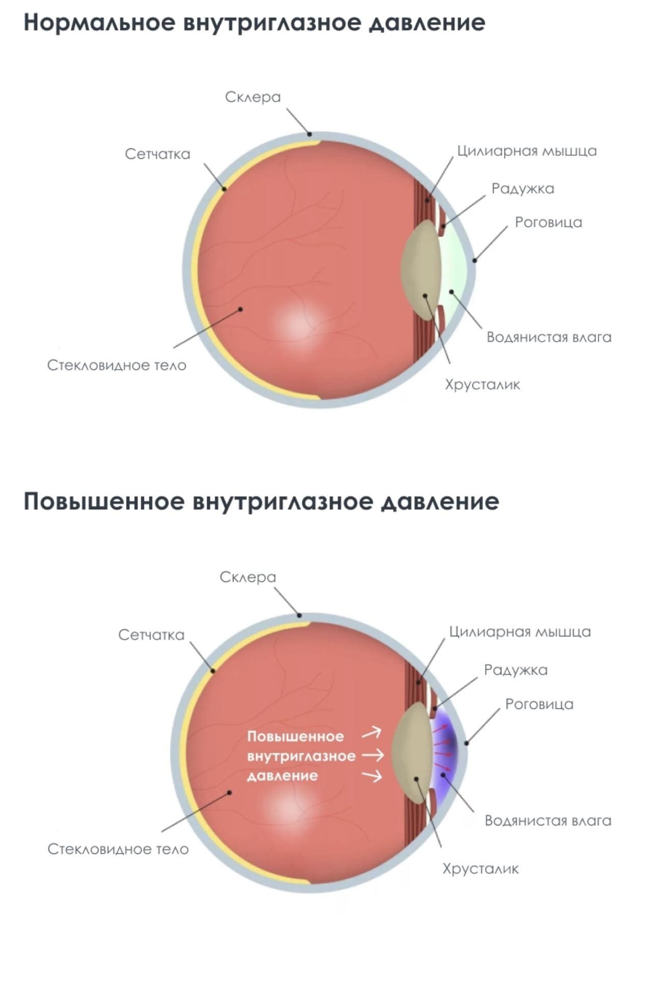 контроль-внутриглазного-давления-ключ-к-раннему-выявлению-глаукомы-01