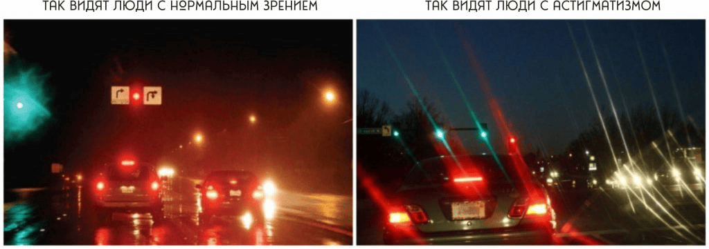 Mir_pri_astigmatizme