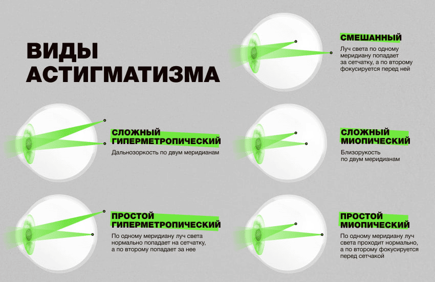 Mir_pri_astigmatizme_-2