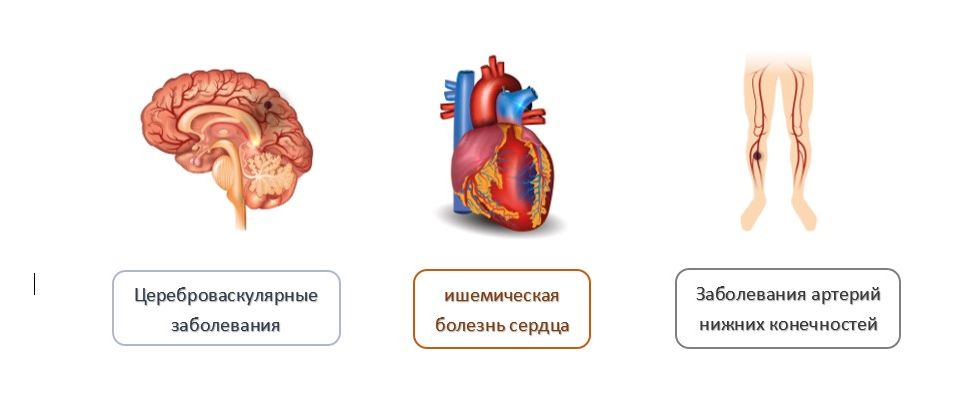 Современные методы лечения и контроля сахарного диабета