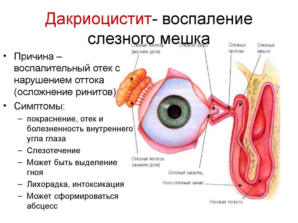 Лечение закупорки слезного канала | Добромед