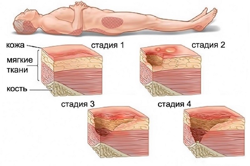 Что делать, когда ваш бизнес терпит неудачу?